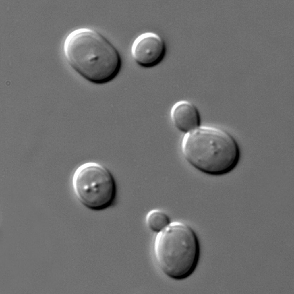 S cerevisiae under DIC microscopy 2 1